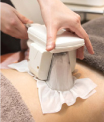 クライオリポライシス施術の様子